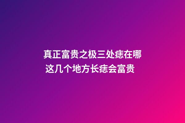 真正富贵之极三处痣在哪 这几个地方长痣会富贵
